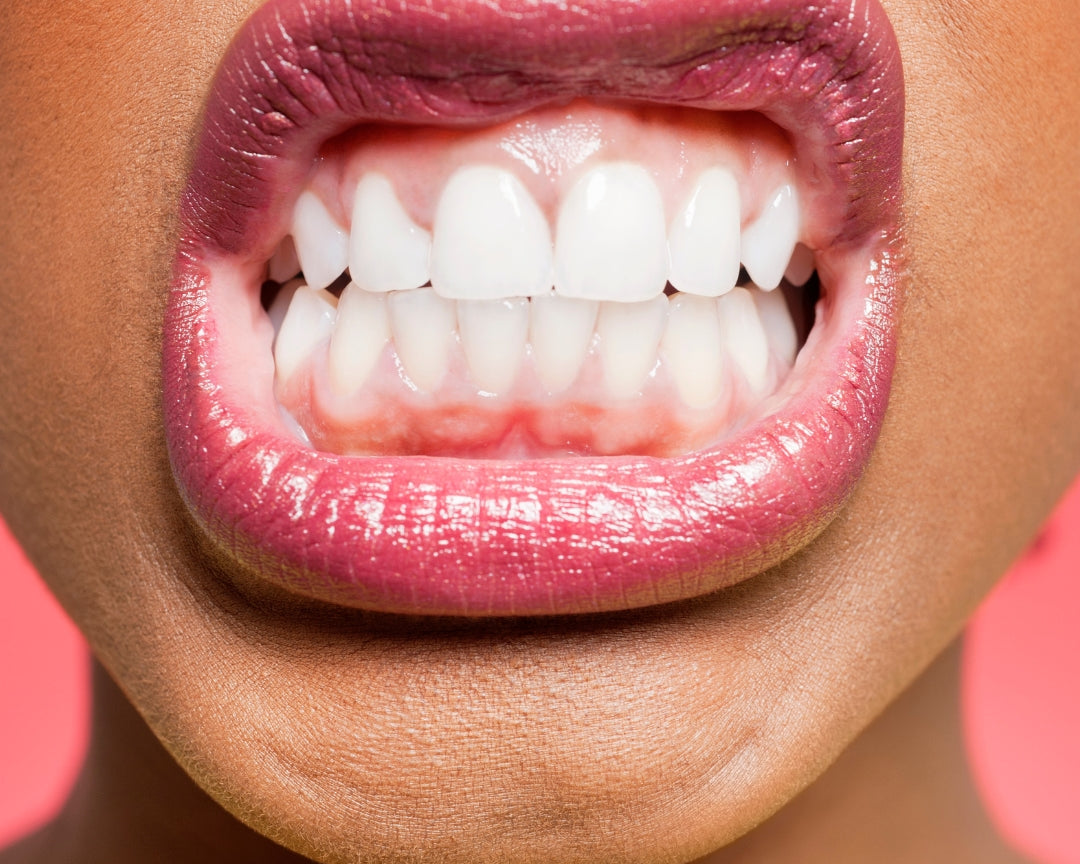 Wie FYYL Gum deine Zahngesundheit unterstützt